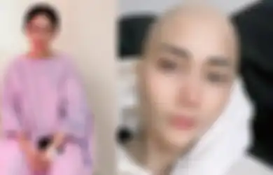 Kanker Payudara Stadium 3 Gerogiti Tubuhnya, Artis Ini Tetap Jadi DJ di Kelab Malam untuk Cari Nafkah, Sedih Rambut Rontok karena Kemoterapi
