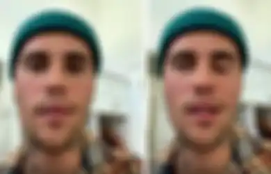Kabar Sedih, Justin Bieber Alami Lumpuh di Wajah, Ternyata Idap Ramsay Hunt Syndrome