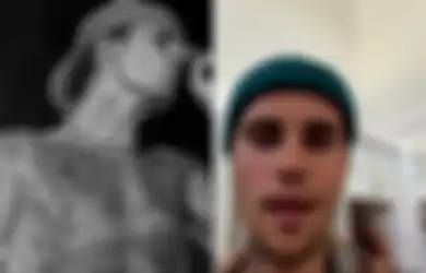 Separuh Wajah Justin Bieber Lumpuh, Suami Hailey Baldwin Diserang Virus Ini: Ini Cukup Serius
