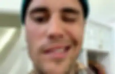 Ramsay Hunt Syndrome yang Dialami Justin Bieber Akibat dari Vaksin COVID-19? Cek Faktanya!