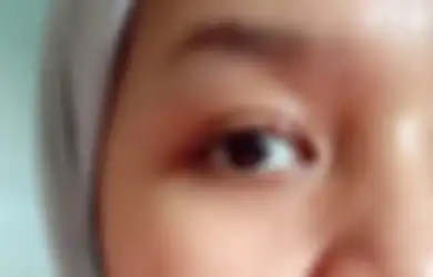4 Penyebab Mata Jadi Bintitan, Gara-Gara Makeup Enggak Dibersihkan!