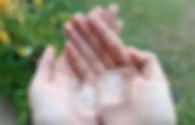 Tips Kesehatan, Salah Satunya Bisa Kompres Es, Inilah 4 Cara Mengatasi Asam Urat Tanpa Obat
