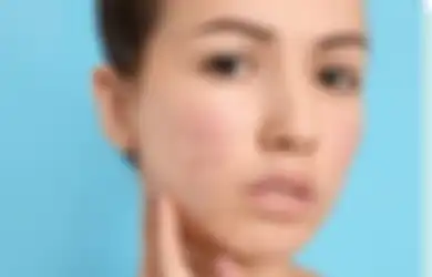 Aneka Tips Kecantikan, Begini Cara Hilangkan Bekas Jerawat Secara Alami, Bahan-bahannya Ada di Dapur Rumah Loh!