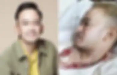 Dokter Sampai Syok! Terdapat Bintik-bintik di Bagian Otak Ruben Onsu, sang Presenter Sampai Harus Jalani Transfusi Darah hingga 7 Kantong