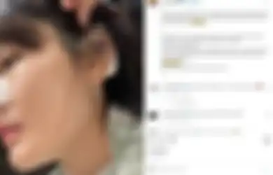 Dulu Terjerat Utang Rp 26 M, Artis Cantik Kini Nasibnya Pilu, Gagal Oplas Hidung dan Jaringan Kulit Jebol, Begini Kondisinya Sekarang