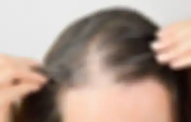 Nggak Perlu Pusing Tujuh Keliling, Olesi Rambut dengan Minyak Kemiri Punya Efek Luar Biasa Hilangkan Ketombe di Kulit Kepala