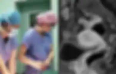 GEGER Pria Ini Alami Menstruasi hingga Miliki Rahim, Fakta Mencengangkan Tersebut Terungkap Setelah 30 Tahun, Dokter Syok