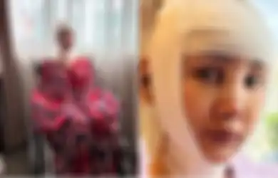 'Sudah Berubah Wujud', Rela Bolak-balik Permak Wajah di Korea, Hasil Operasi Plastik Lucinta Luna Bocor, Intip Potretnya yang Disebut Mirip Sosok Ini