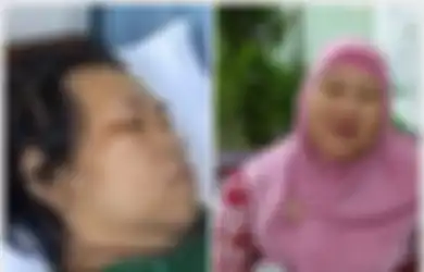 Biodata Artis Rini S Bon Bon, Pelawak Era 90-an yang Meninggal Dunia di Usia 51 Tahun Usai Berjuang Lawan Penyakit Diabetes Melitus, Kakinya Pernah Nyaris Diamputasi Gegara Peniti
