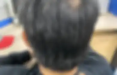 Aneka Tips Kecantikan, Sederet Bahan Alami untuk Usir Uban di Rambut, Hemat Budget!