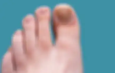 Begini 5 Cara Menghilangkan Noda Hitam di Kuku Kaki Cuma Pakai Garam