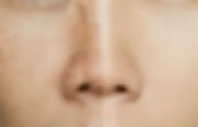 Flek Hitam Nyaris Lenyap, Gula Pasir Bisa Jadi Solusi Ampuh Pengganti Skincare Mahal yang Bikin Kantong Kering