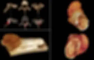 Berusia 1,7 Juta Tahun, Tulang Kaki yang Ditemukan Peneliti Ini Terbukti Adanya Kanker, Jadi Apakah Diet Paleo yang Dilakukan Manusia Purba Bisa Hilangkan Penyakit Mematikan Itu?
