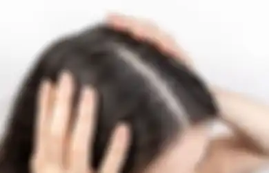 Kerap Jadi Momok Kulit Kepala, Simak Tips Hidup Hempaskan Ketombe di Rambut Cukup dengan Bahan Alami Ini, Jangan Kaget Lihat Perubahannya saat Dibilas!
