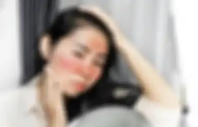 Masih Malas Pakai Sunscreen dari Sekarang? Awas, 10 Masalah Kulit Ini!