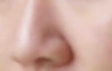 Tips Hidup Hempas Komedo yang Membandel di Hidung dengan Cepat dan Mudah, Cukup Gunakan Bahan Alami Ini
