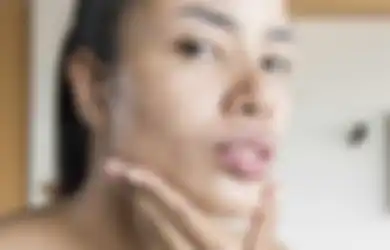 Ini 5 Langkah yang Benar Untuk Memperbaiki Kulit Wajah Bertekstur!