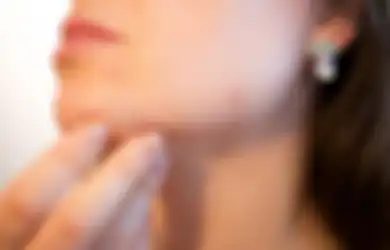 Tips Mencegah Jerawat pada Masa Pubertas, 5 Cara Ini Bisa Kalian Coba