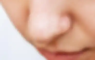 5 Cara Ampuh Mengatasi Pori-pori Besar Dihidung, Simak dan Ikuti