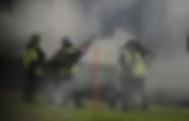 Tercatat 132 Orang Tewas, Kondisi Pilu Korban Tragedi Kanjuruhan yang Selamat Alami Mata Merah Akibat Gas Air Mata Kadaluwarsa