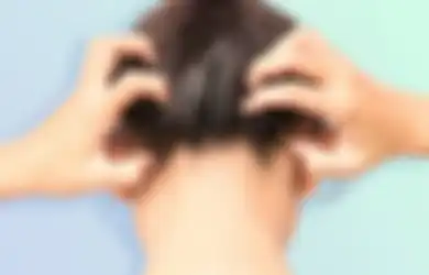 Tips Hidup, Cara Aman Redakan Gatal Bagi Pengidap Psoriasis di Kulit Kepala Tanpa Digaruk, Cukup Pakai 2 Bahan Ini