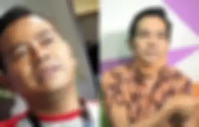 Biodata Artis Yadi Sembako dan Kabar Terbarunya, Begini Keadaan Sang Komedian Usai Jatuh Sakit, Badan Kurus Teman Tak Urus