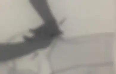Cukup Praktikkan Langkah Ini, Begini Cara Pijat Atasi Nyeri Saat Haid