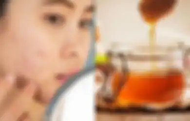 Aneka Tips Kecantikan, Begini Cara Menghilangkan Bopeng Bekas Jerawat Secara Alami, Cuma Modal Madu yang Dipakai Seperti Ini