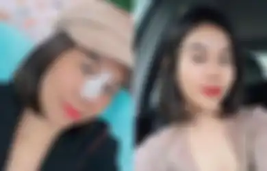 Rogoh Kocek Puluhan Juta Demi Permak Penampilan Wajah, Mayang Ngaku Lakukan Hal ini pada Dokter yang Operasi Plastik Padanya