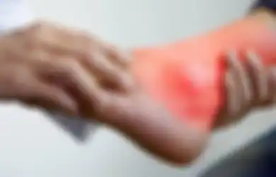 Ajaib! Rambut Jagung Bisa Dijadikan Ramuan untuk Tumpas Asam Urat Tanpa Efek Samping, Begini Caranya