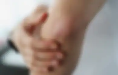 Terawat! Gini 5 Cara Cepat Mengatasi Kulit Siku yang Kering dan Hitam
