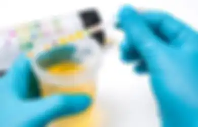 Urine Berbusa? Jadi Tanda Diabetes dan 3 Masalah Kesehatan Ini!