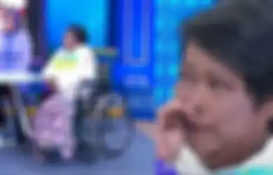 Kini Belajar Pakai Kaki Palsu, Suti Karno Mohon Maaf pada Tuhan karena Terpaksa Kakinya Diamputasi Gegara 18 Tahun Derita Penyakit Ini: Merambat Lukanya