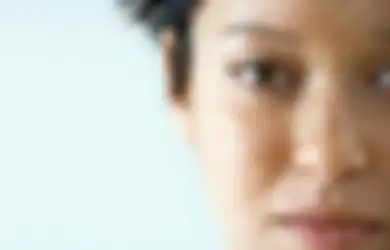 Punya Melasma di Kulit Wajah? Singkirkan Segera dengan Cara Ini!