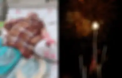 Wakil Bupati Kaur Terkena Ledakan Kembang Api hingga Operasi Jari Tangan, Nyalakan Kembang Api dengan Cara Ini Berisiko Timbulkan Cedera