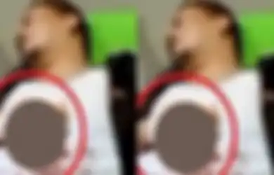 VIRAL Jari Wakil Bupati Kaur Terluka Kena Ledakan Kembang Api, Begini Tips Aman Bermain Petasan yang Perlu Diketahui