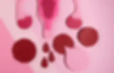 Kenali Penyebab Penyakit Miom yang Menghantui Wanita, Waspadai Mulai Sekarang