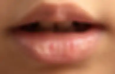 Hindari Kebiasaan Gigit hingga Jilati Bibir, Ini 7 Cara Mengatasi Bibir Kering yang Perlu Diketahui