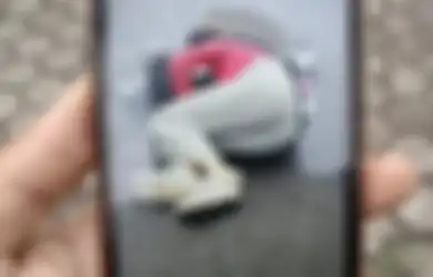 Kapolri Selidiki Foto Viral Mahasiswi Korban Tabrak Lari Pejabat Polisi, Keluarga Buka Suara