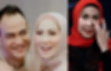 Kena KDRT Ferry Irawan, Ternyata Ini yang Sebabkan Hidung Venna Melinda Bercucuran Darah: Bukan Patah...