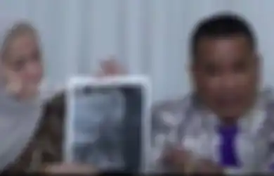 Dituding Ferry Irawan Pukuli Diri Sendiri, Venna Melinda Melawan dengan Tunjukkan Hasil Visum: Dia Bukan Imam yang Saya Cari