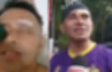 Niat Hati Olahraga Cari Sehat, Artis Ini Justru Alami Insiden Sampai Sebabkan Pelipis Matanya Berlumuran Darah, Ini Kronologi Lengkapnya