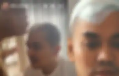 Tatapannya Seperti Kosong, Manajer Sebut Penglihatan Indra Bekti Masih Terganggu, Diduga Ada Stroke