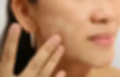 Ternyata Ini Penyebab Bintik Putih di Wajah, Bagaimana Mengatasinya?