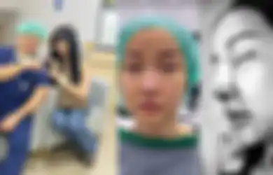 Lucinta Luna Jalani Permak Hidung Usai Dihujat Bak Pinokio, Begini Wujudnya yang Justru Memprihatinkan