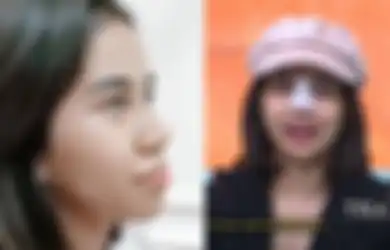 Kecanduan Oplas Demi Tampil Glow Up, Mayang Berencana Akan Rombak Hidungnya Jadi Makin Lancip