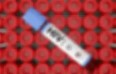 4 Hal Ini Ternyata Bisa Membuat Seseorang Lebih Berisiko Terkena HIV, Yuk Mulai Waspada dari Sekarang!