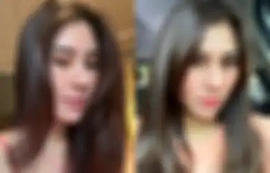 Benarkah Operasi Plastik? Potret Terbaru Syahnaz Sadiqah Bikin Pangling, Bentuk Hidung dan Bibir Langsung Jadi Sorotan