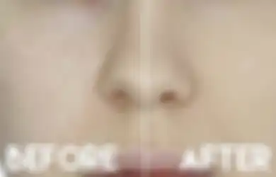 Begini Cara Menyamarkan Pori-pori Besar Dengan Makeup, Ikuti Girls