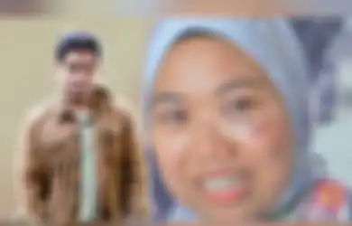 'Lebih Menyakitkan dari Melahirkan', Mengaku Ditinju Mantan Suami yang Berprofesi Aktor, Wanita Ini Dapat 10 Jahitan di Pipi
